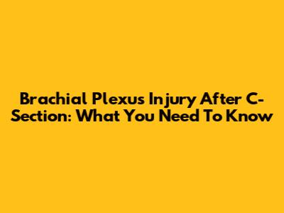 Brachial Plexus Injury After C-Section: What You Need To Know